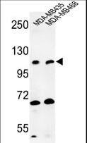 EXTL3 Antibody - Western blot of EXTL3 Antibody in MDA-MB435, MDA-MB468 cell line lysates (35 ug/lane). EXTL3 (arrow) was detected using the purified antibody.
