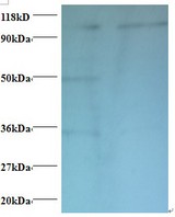 EXTL3 Antibody - Western blot of Exostosin-like 3 antibody at 2 ug/ml. Lane 1: EC109 whole cell lysate. Lane 2: 293T whole cell lysate. Secondary: Goat polyclonal to Rabbit IgG at 1:15000 dilution. Predicted band size: 101 kDa. Observed band size: 101 kDa Additional bands at: 50 kDa. ã€34 kDa. We are unsure as to the identity of this extra bands.  This image was taken for the unconjugated form of this product. Other forms have not been tested.