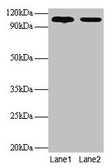 EXTL3 Antibody - Western blot All lanes: Exostosin-like 3 antibody at 2µg/ml Lane 1: EC109 whole cell lysate Lane 2: 293T whole cell lysate Secondary Goat polyclonal to rabbit IgG at 1/15000 dilution Predicted bane side: 101 kDa Observed band side: 101 kDa