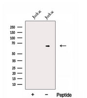 EXTL3 Antibody - Western blot analysis of extracts of Jurkat cells using EXTL3 antibody. The lane on the left was treated with blocking peptide.
