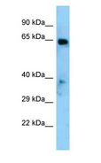 EYA1 Antibody - EYA1 antibody Western Blot of Mouse Heart.  This image was taken for the unconjugated form of this product. Other forms have not been tested.