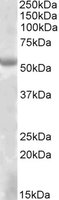 EYA1 Antibody - EYA1 antibody (2 ug/ml) staining of HEK293 lysate (35 ug protein in RIPA buffer). Primary incubation was 1 hour. Detected by chemiluminescence.