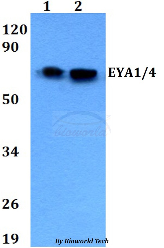 EYA1 Antibody - Western blot of EYA1/4 antibody at 1:500 dilution. Lane 1: A549 whole cell lysate. Lane 2: H9C2 whole cell lysate.