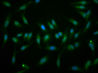 EYA1 Antibody - Immunofluorescence staining of Hela cells at a dilution of 1:166, counter-stained with DAPI. The cells were fixed in 4% formaldehyde, permeabilized using 0.2% Triton X-100 and blocked in 10% normal Goat Serum. The cells were then incubated with the antibody overnight at 4 °C.The secondary antibody was Alexa Fluor 488-congugated AffiniPure Goat Anti-Rabbit IgG (H+L) .