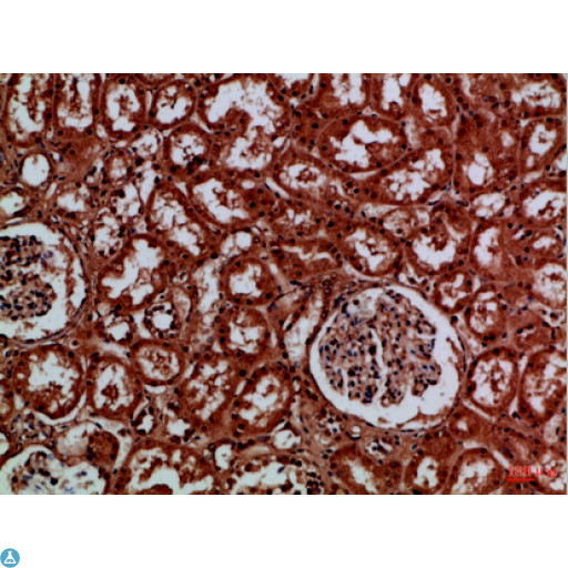 EYA1 Antibody - Immunohistochemical analysis of paraffin-embedded human-kidney, antibody was diluted at 1:100.