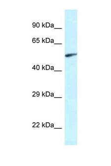 EYA2 Antibody - EYA2 antibody Western blot of Rat Muscle lysate. Antibody concentration 1 ug/ml.  This image was taken for the unconjugated form of this product. Other forms have not been tested.
