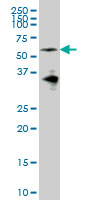 EYA2 Antibody - EYA2 monoclonal antibody (M04), clone 2F8 Western Blot analysis of EYA2 expression in IMR-32.