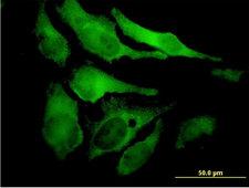 EYA2 Antibody - Immunofluorescence of monoclonal antibody to EYA2 on HeLa cell. [antibody concentration 10 ug/ml]