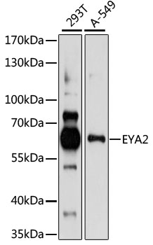 EYA2 Antibody - Western blot analysis of extracts of various cell lines, using EYA2 antibody at 1:1000 dilution. The secondary antibody used was an HRP Goat Anti-Rabbit IgG (H+L) at 1:10000 dilution. Lysates were loaded 25ug per lane and 3% nonfat dry milk in TBST was used for blocking. An ECL Kit was used for detection and the exposure time was 60s.