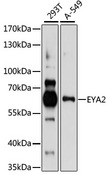 EYA2 Antibody - Western blot analysis of extracts of various cell lines, using EYA2 antibody at 1:1000 dilution. The secondary antibody used was an HRP Goat Anti-Rabbit IgG (H+L) at 1:10000 dilution. Lysates were loaded 25ug per lane and 3% nonfat dry milk in TBST was used for blocking. An ECL Kit was used for detection and the exposure time was 60s.