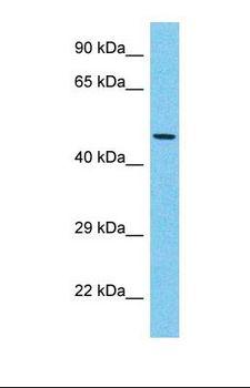 EYA3 Antibody - Western blot of Human Thymus Tumor. EYA3 antibody dilution 1.0 ug/ml.  This image was taken for the unconjugated form of this product. Other forms have not been tested.