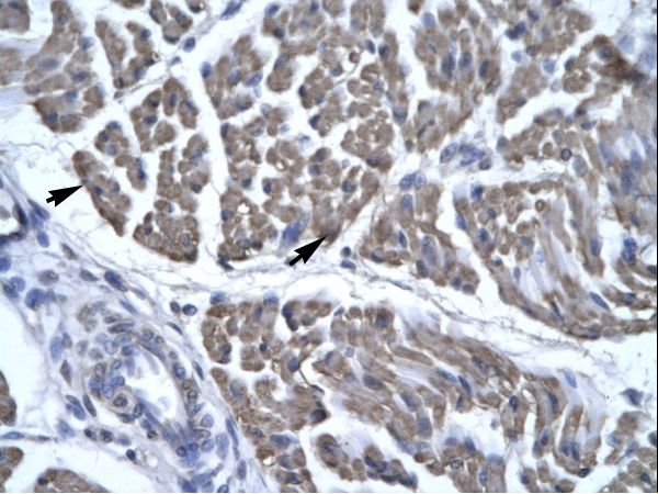 EYA3 Antibody - Human Skeletal Muscle.  This image was taken for the unconjugated form of this product. Other forms have not been tested.