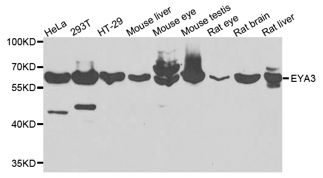 EYA3 Antibody - Western blot analysis of extracts of various cells.
