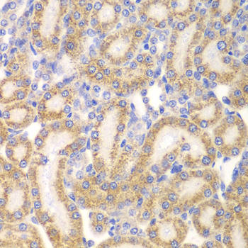 EYA3 Antibody - Immunohistochemistry of paraffin-embedded rat kidney tissue.