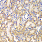 EYA3 Antibody - Immunohistochemistry of paraffin-embedded rat kidney tissue.