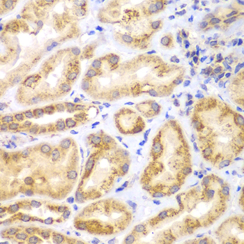 EYA3 Antibody - Immunohistochemistry of paraffin-embedded human kidney tissue.