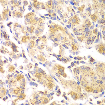 EYA3 Antibody - Immunohistochemistry of paraffin-embedded human gastric tissue.