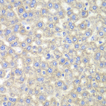 EYA3 Antibody - Immunohistochemistry of paraffin-embedded mouse liver tissue.
