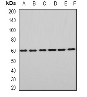 EYA3 Antibody - Western blot analysis of EYA3 expression in HeLa (A); HT29 (B); mouse eye (C); mouse testis (D); rat brain (E); rat liver (F) whole cell lysates.