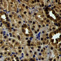 EYA3 Antibody - Immunohistochemical analysis of EYA3 staining in rat kidney formalin fixed paraffin embedded tissue section. The section was pre-treated using heat mediated antigen retrieval with sodium citrate buffer (pH 6.0). The section was then incubated with the antibody at room temperature and detected using an HRP conjugated compact polymer system. DAB was used as the chromogen. The section was then counterstained with hematoxylin and mounted with DPX.