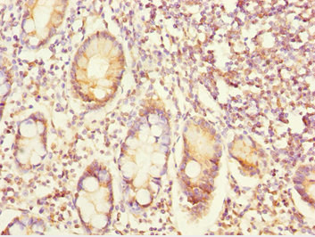 EYA3 Antibody - Immunohistochemistry of paraffin-embedded human small intestine tissue at dilution 1:100