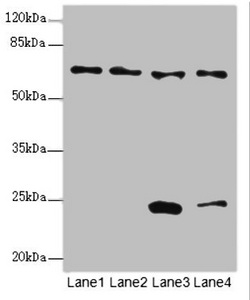 EYA3 Antibody - Western blot All Lanes:EYA3 antibody at 1.49ug/ml Lane 1 : Hela whole cell lysate Lane 2 : 293T whole cell lysate Lane 3 : Mouse liver tissue Lane 4 : HT29 whole cell lysate Secondary Goat polyclonal to Rabbit IgG at 1/10000 dilution Predicted band size: 63,49,59,57,58 kDa Observed band size: 63,24 kDa