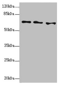 EYA3 Antibody - Western blot All lanes: EYA3 antibody at 1.49µg/ml Lane 1: Hela whole cell lysate Lane 2: 293T whole cell lysate Lane 3: HT29 whole cell lysate Secondary Goat polyclonal to rabbit IgG at 1/10000 dilution Predicted band size: 63, 49, 59, 57, 58 kDa Observed band size: 63 kDa