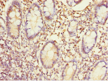 EYA3 Antibody - Immunohistochemistry of paraffin-embedded human small intestine tissue at dilution 1:100