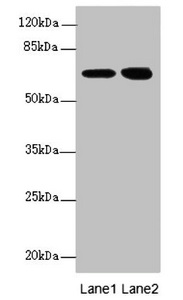 EYA3 Antibody - Western blot All Lanes:EYA3 antibody at 2.88ug/ml Lane 1 : Hela whole cell lysate Lane 2 : 293T whole cell lysate Secondary Goat polyclonal to Rabbit IgG at 1/10000 dilution Predicted band size: 63,49,59,57,58 kDa Observed band size: 63,67 kDa