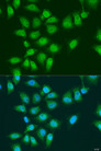EYA3 Antibody - Immunofluorescence analysis of U2OS cells using EYA3 antibody at dilution of 1:100. Blue: DAPI for nuclear staining.