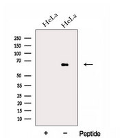 EYA3 Antibody - Western blot analysis of extracts of HeLa cells using EYA3 antibody. The lane on the left was treated with blocking peptide.