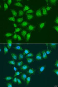 EYA3 Antibody - Immunofluorescence analysis of U2OS cells using EYA3 Polyclonal Antibody at dilution of 1:100.Blue: DAPI for nuclear staining.