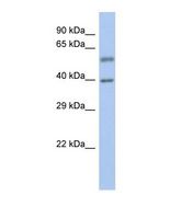 EYA3 Antibody - Western blot of Human Fetal Spleen. EYA3 antibody dilution 1.0 ug/ml.  This image was taken for the unconjugated form of this product. Other forms have not been tested.