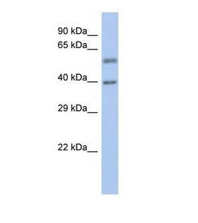 EYA3 Antibody - Western blot of Human Fetal Spleen. EYA3 antibody dilution 1.0 ug/ml.  This image was taken for the unconjugated form of this product. Other forms have not been tested.