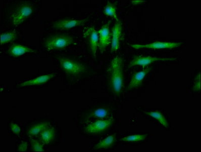 EYA4 Antibody - Immunofluorescence staining of Hela cells at a dilution of 1:200, counter-stained with DAPI. The cells were fixed in 4% formaldehyde, permeabilized using 0.2% Triton X-100 and blocked in 10% normal Goat Serum. The cells were then incubated with the antibody overnight at 4 °C.The secondary antibody was Alexa Fluor 488-congugated AffiniPure Goat Anti-Rabbit IgG (H+L) .