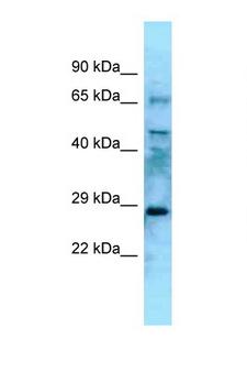 EYA4 Antibody - EYA4 antibody Western blot of Mouse Thymus lysate. Antibody concentration 1 ug/ml.  This image was taken for the unconjugated form of this product. Other forms have not been tested.