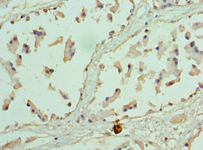 EZH1 / ENX-2 Antibody - Immunohistochemistry of paraffin-embedded human prostate tissue using EZH1 Antibody at dilution of 1:100