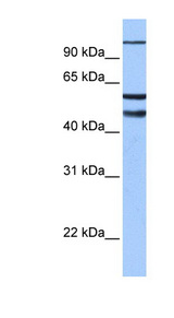 EZH1 / ENX-2 Antibody - EZH1 antibody Western blot of Fetal Brain lysate. This image was taken for the unconjugated form of this product. Other forms have not been tested.