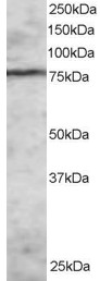 EZH1 / ENX-2 Antibody - Antibody staining (2 ug/ml) of MOLT-4 lysate (RIPA buffer, 30 ug total protein per lane). Primary incubated for 1 hour. Detected by Western blot of chemiluminescence.