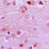 EZH1 / ENX-2 Antibody - Immunohistochemical analysis of EZH1 staining in human brain formalin fixed paraffin embedded tissue section. The section was pre-treated using heat mediated antigen retrieval with sodium citrate buffer (pH 6.0). The section was then incubated with the antibody at room temperature and detected using an HRP conjugated compact polymer system. DAB was used as the chromogen. The section was then counterstained with hematoxylin and mounted with DPX.