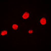 EZH1 / ENX-2 Antibody - Immunofluorescent analysis of EZH1 staining in HeLa cells. Formalin-fixed cells were permeabilized with 0.1% Triton X-100 in TBS for 5-10 minutes and blocked with 3% BSA-PBS for 30 minutes at room temperature. Cells were probed with the primary antibody in 3% BSA-PBS and incubated overnight at 4 C in a humidified chamber. Cells were washed with PBST and incubated with a DyLight 594-conjugated secondary antibody (red) in PBS at room temperature in the dark. DAPI was used to stain the cell nuclei (blue).
