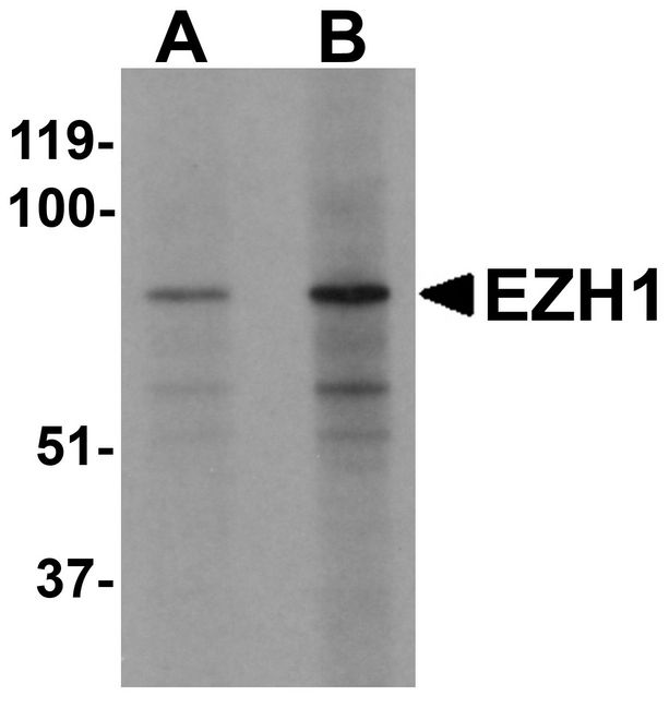 EZH1 / ENX-2 Antibody - Western blot analysis of EZH1 in mouse lung tissue lysate with EZH1 antibody at (A) 1 and (B) 2 ug/ml