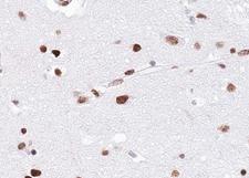 EZH1 / ENX-2 Antibody - 1:100 staining human brain tissue by IHC-P. The tissue was formaldehyde fixed and a heat mediated antigen retrieval step in citrate buffer was performed. The tissue was then blocked and incubated with the antibody for 1.5 hours at 22°C. An HRP conjugated goat anti-rabbit antibody was used as the secondary.