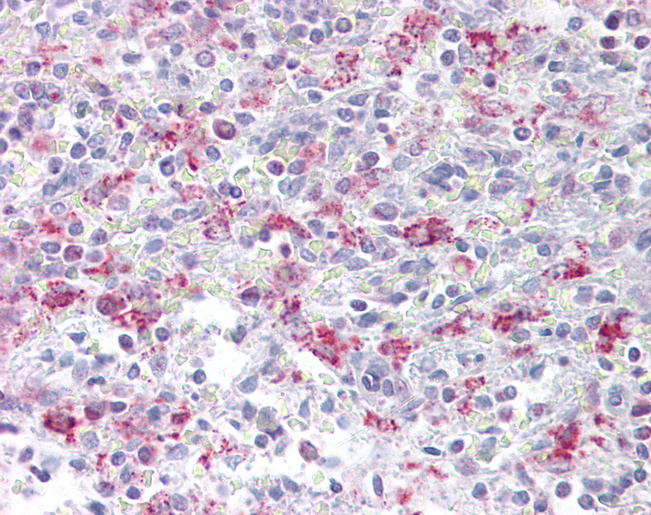 EZH1 / ENX-2 Antibody - Anti-EZH1 antibody IHC of human spleen. Immunohistochemistry of formalin-fixed, paraffin-embedded tissue after heat-induced antigen retrieval. Antibody concentration 5 ug/ml.  This image was taken for the unconjugated form of this product. Other forms have not been tested.