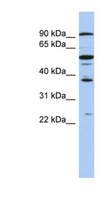 EZH1 / ENX-2 Antibody - EZH1 antibody Western blot of COLO205 cell lysate. This image was taken for the unconjugated form of this product. Other forms have not been tested.