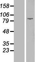 EZH1 / ENX-2 Protein - Western validation with an anti-DDK antibody * L: Control HEK293 lysate R: Over-expression lysate
