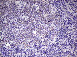 EZH2 Antibody - IHC of paraffin-embedded Human lymph node tissue using anti-EZH2 mouse monoclonal antibody. (Heat-induced epitope retrieval by 10mM citric buffer, pH6.0, 120°C for 3min).