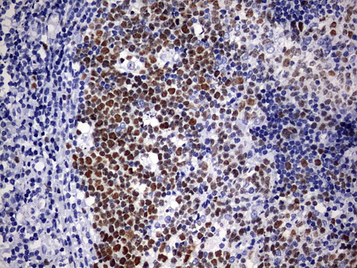 EZH2 Antibody - IHC of paraffin-embedded Human tonsil using anti-EZH2 mouse monoclonal antibody. (Heat-induced epitope retrieval by 1 mM EDTA in 10mM Tris, pH9.0, 120°C for 3min).