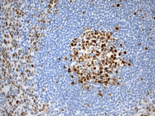 EZH2 Antibody - Immunohistochemical staining of paraffin-embedded Human tonsil within the normal limits using anti-EZH2 mouse monoclonal antibody. (Heat-induced epitope retrieval by 1mM EDTA in 10mM Tris buffer. (pH9.0) at 120°C for 2.5 min. (1:100)