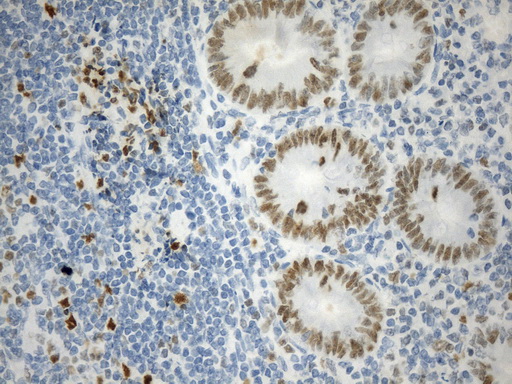 EZH2 Antibody - Immunohistochemical staining of paraffin-embedded Human appendix tissue within the normal limits using anti-EZH2 mouse monoclonal antibody. (Heat-induced epitope retrieval by 1mM EDTA in 10mM Tris buffer. (pH9.0) at 120°C for 2.5 min. (1:100)
